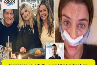 Sami Sheen Reveals New Look After Scarless Nose Rhinoplasty