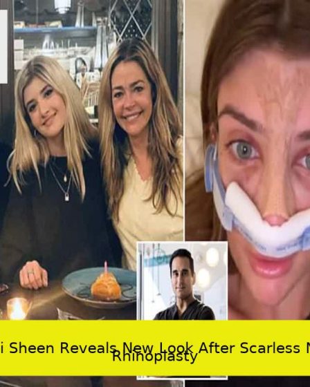 Sami Sheen Reveals New Look After Scarless Nose Rhinoplasty