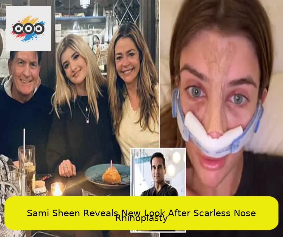 Sami Sheen Reveals New Look After Scarless Nose Rhinoplasty