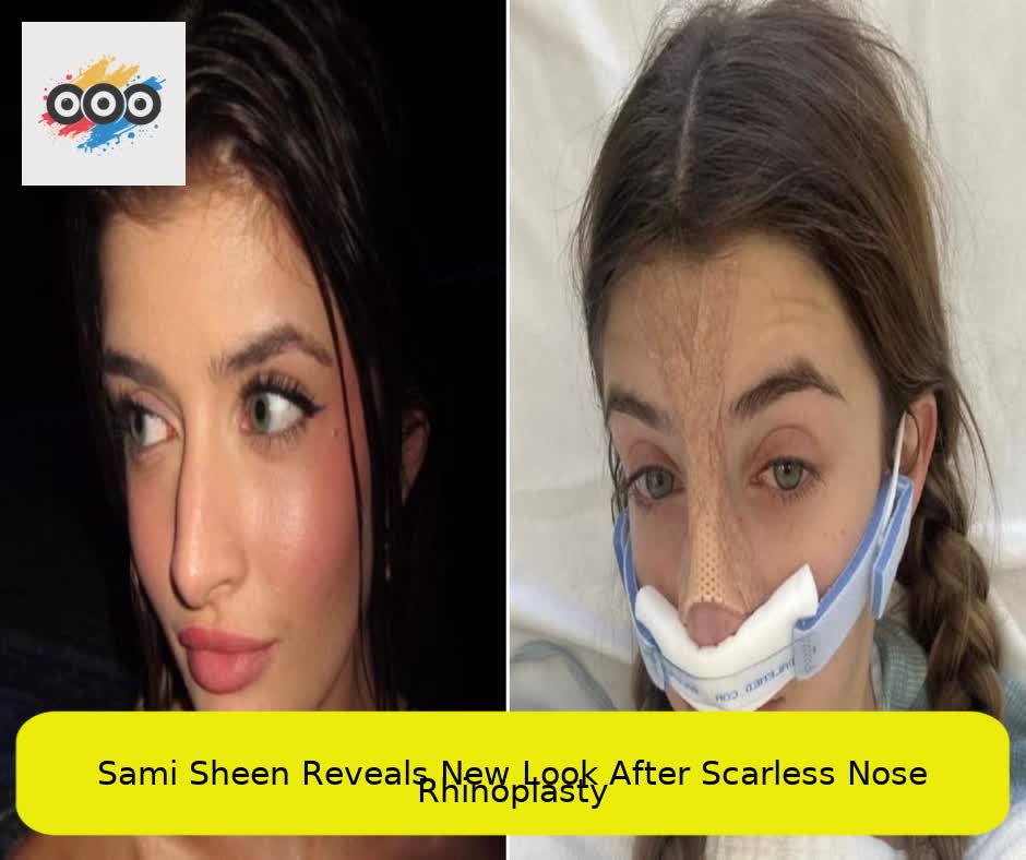 Sami Sheen Reveals New Look After Scarless Nose Rhinoplasty